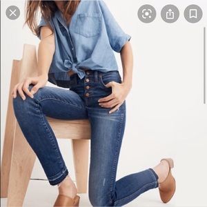 Madewell Button fly skinny jeans